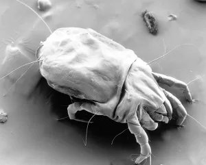 Dust mite under microscope (electron micrograph)